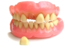 Ремонт выпадения искусственного зуба из протеза