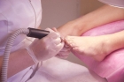 Мягкое протезирование ногтей гелем Nagelmassa (Маленький ноготь на ноге)