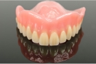 Частичные зубные протезы
