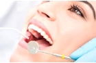 Комплексная чистка зубов от налета